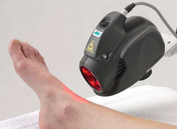 Radial Shockwave Therapy MLS Laser Therapy in the Memphis, TN 38117 area